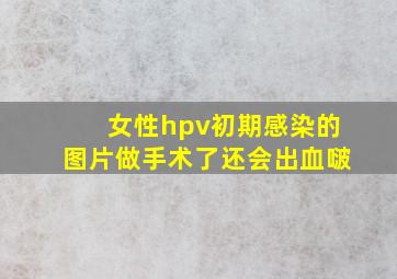 女性hpv初期感染的图片做手术了还会出血啵