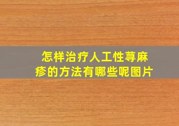 怎样治疗人工性荨麻疹的方法有哪些呢图片