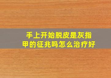 手上开始脱皮是灰指甲的征兆吗怎么治疗好