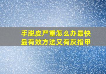 手脱皮严重怎么办最快最有效方法又有灰指甲