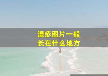 湿疹图片一般长在什么地方