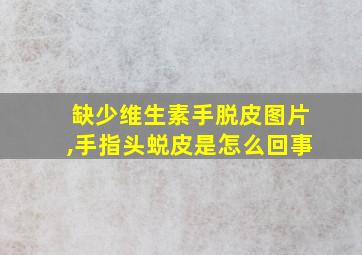 缺少维生素手脱皮图片,手指头蜕皮是怎么回事