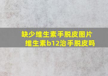 缺少维生素手脱皮图片维生素b12治手脱皮吗