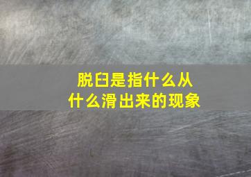 脱臼是指什么从什么滑出来的现象